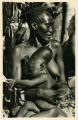 L'Afrique Qui Disparait! 63 - Pr.Or. Mangbetu Déformation du crâne 